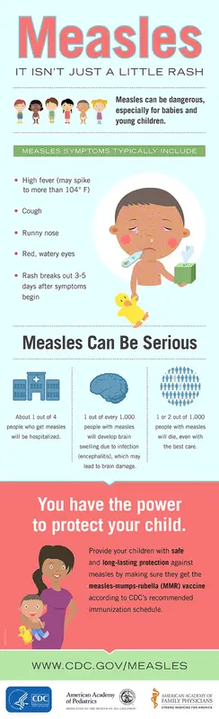 Measles-infographic