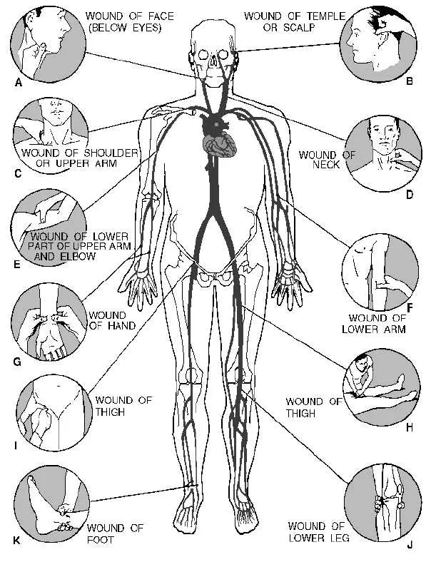 Pressure points