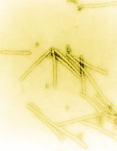 TobaccoMosaicVirus