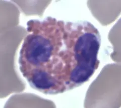 Eosinophil