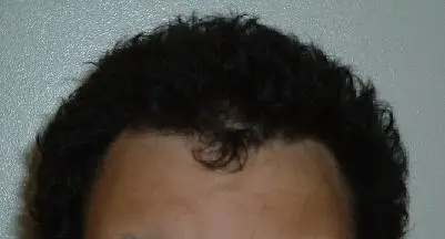 Widpeak